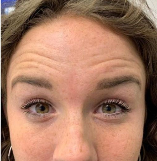 Bőrápolás a LUMINE tapaszok használata előtt