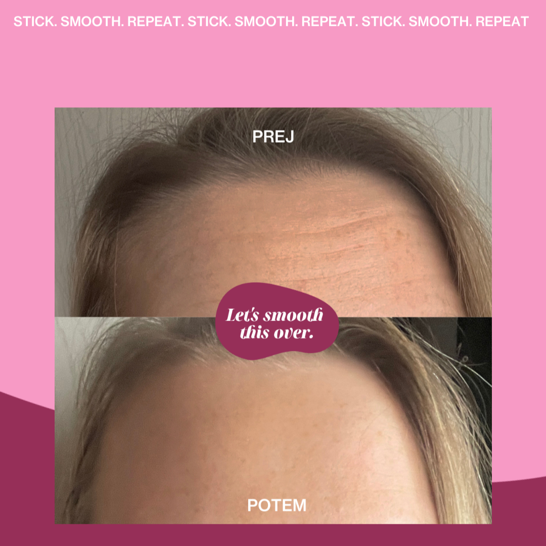 CSOMAG Szilikon homloktapasz 3+1 INGYEN