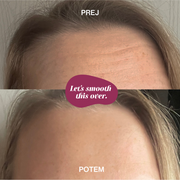 Szemöldökráncokra való szilikon tapasz