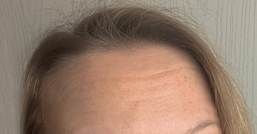 Bőrápolás a LUMINE tapaszok használata előtt